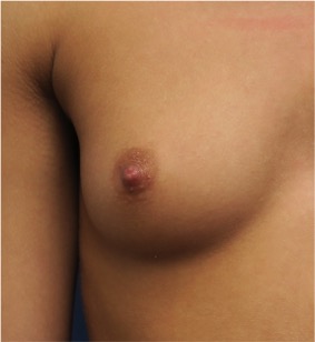 Perfect Nipple Pictures