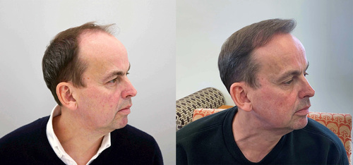 Paul Coyte, before and after