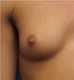 nipple rated as least attractive